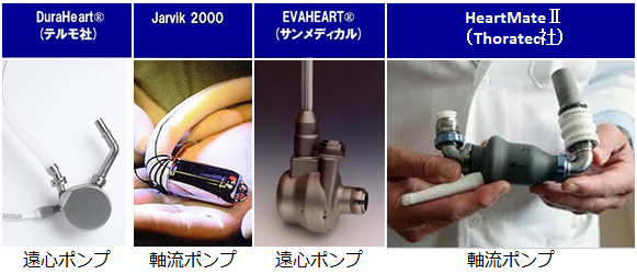 図2.日本で使用可能な植え込み型人工心臓